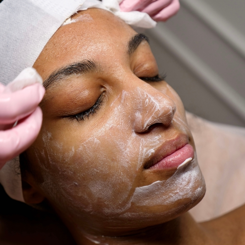 Resultado Spa Facial